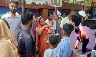 বেঁচে আছে মিরপুরে বিদ্যুৎস্পৃষ্ট হওয়া সেই শিশুটি